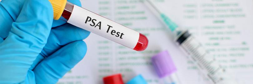 PSA Test